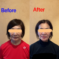美容患者2