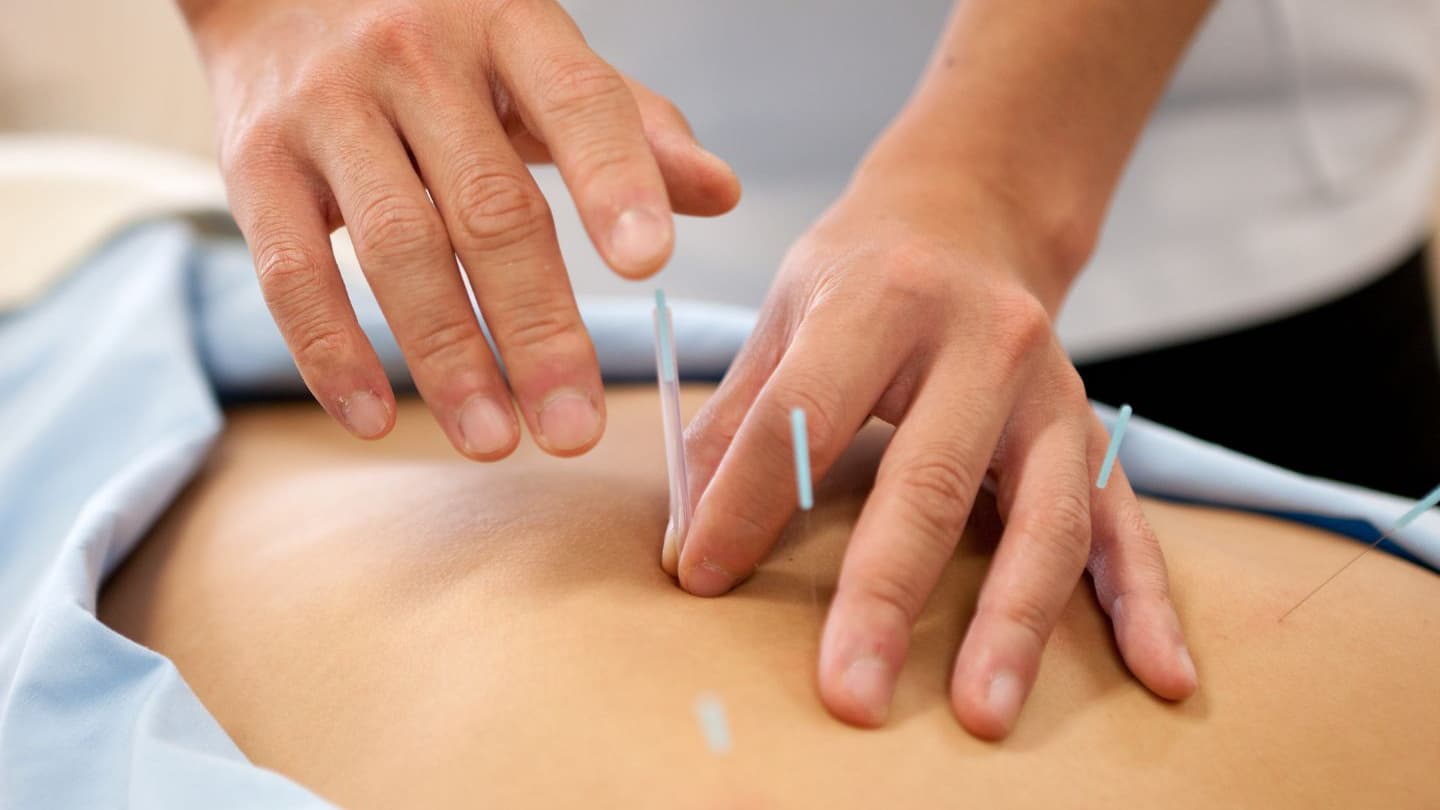 鍼治療